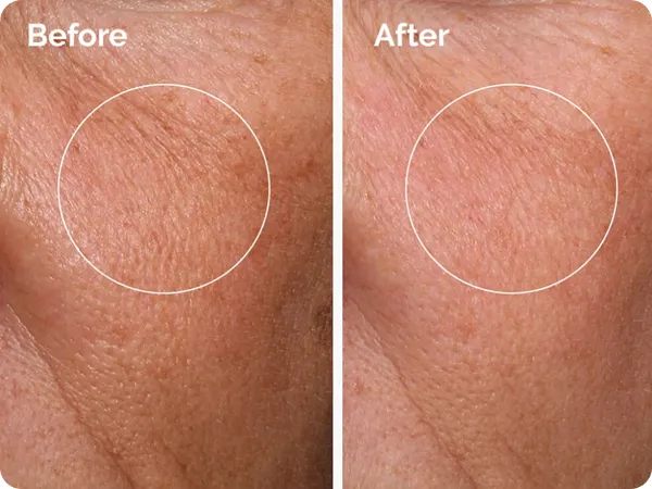 The Ordinary Hyaluronic Acid 2% + B5 - Vista 2